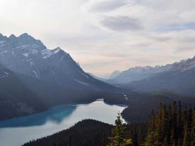 Scientists discover hidden gut trigger behind ALS and dementia